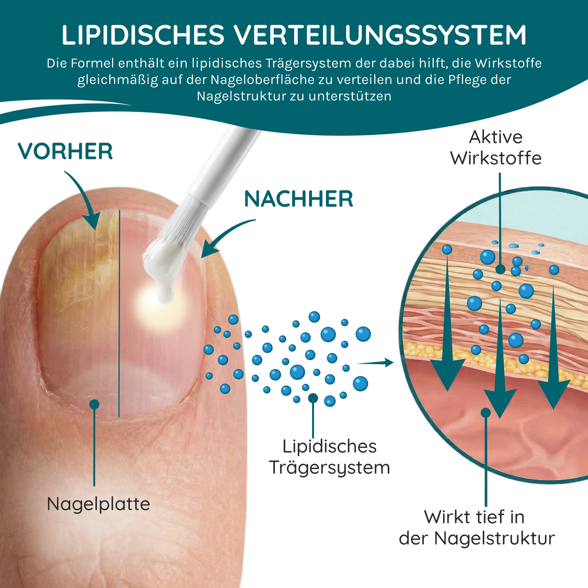 NAGELPILZ Serum - Natürliche Formel mit Teebaumöl & Vitamin E - 10ml