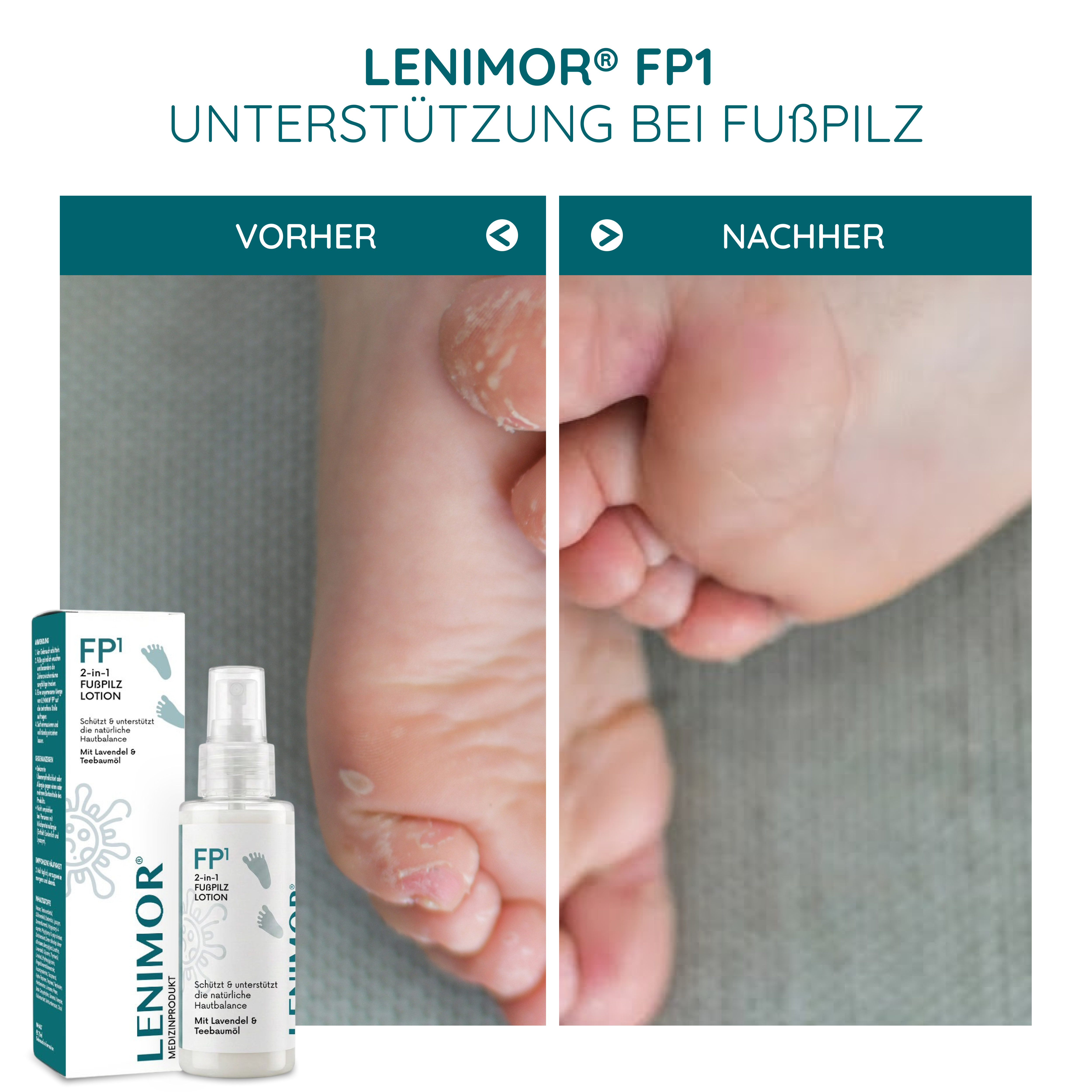 FUßPILZ Spray - Natürliche Formel mit Lavendel & Teebaumöl - 75ml