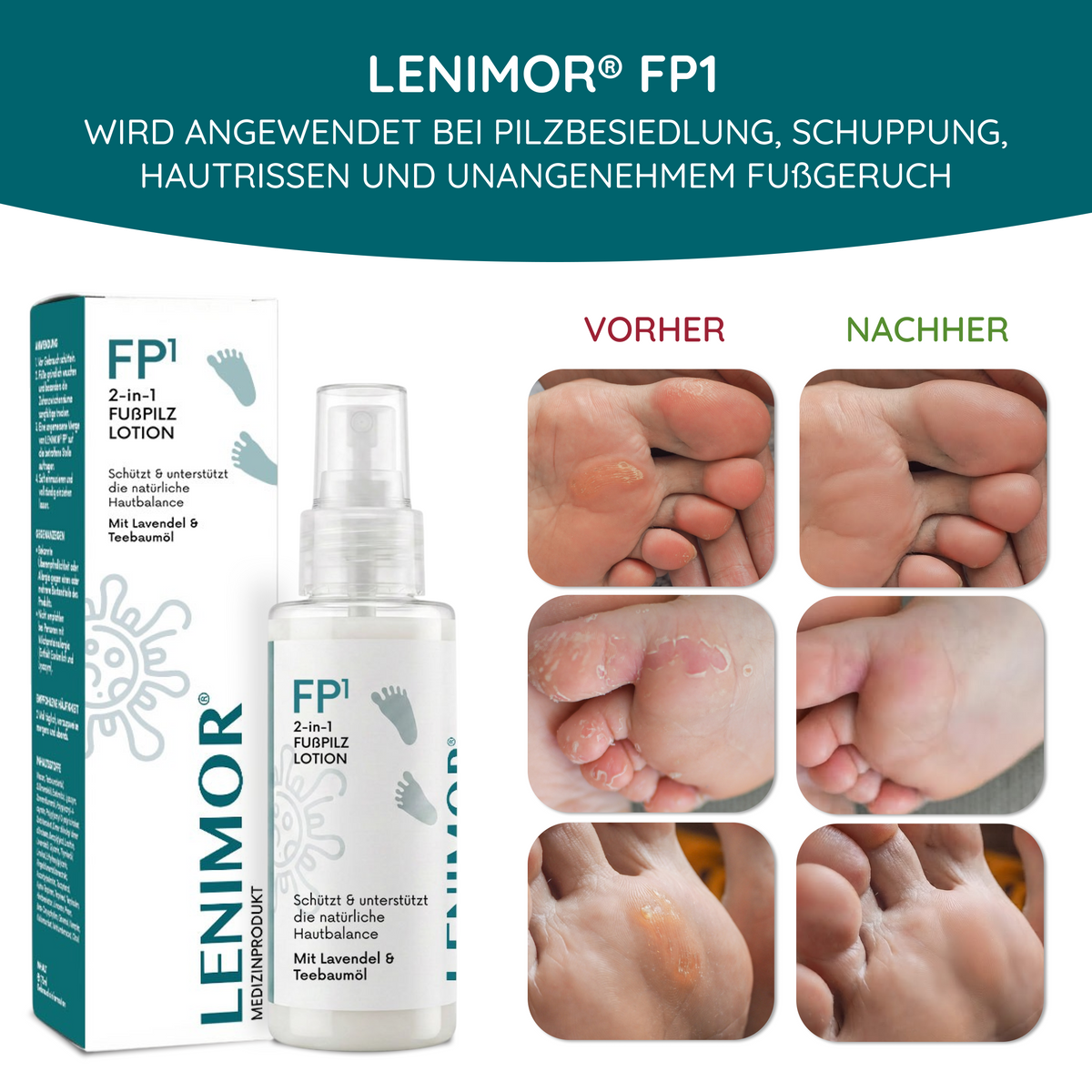 FUßPILZ Spray - Natürliche Formel mit Lavendel & Teebaumöl - 75ml