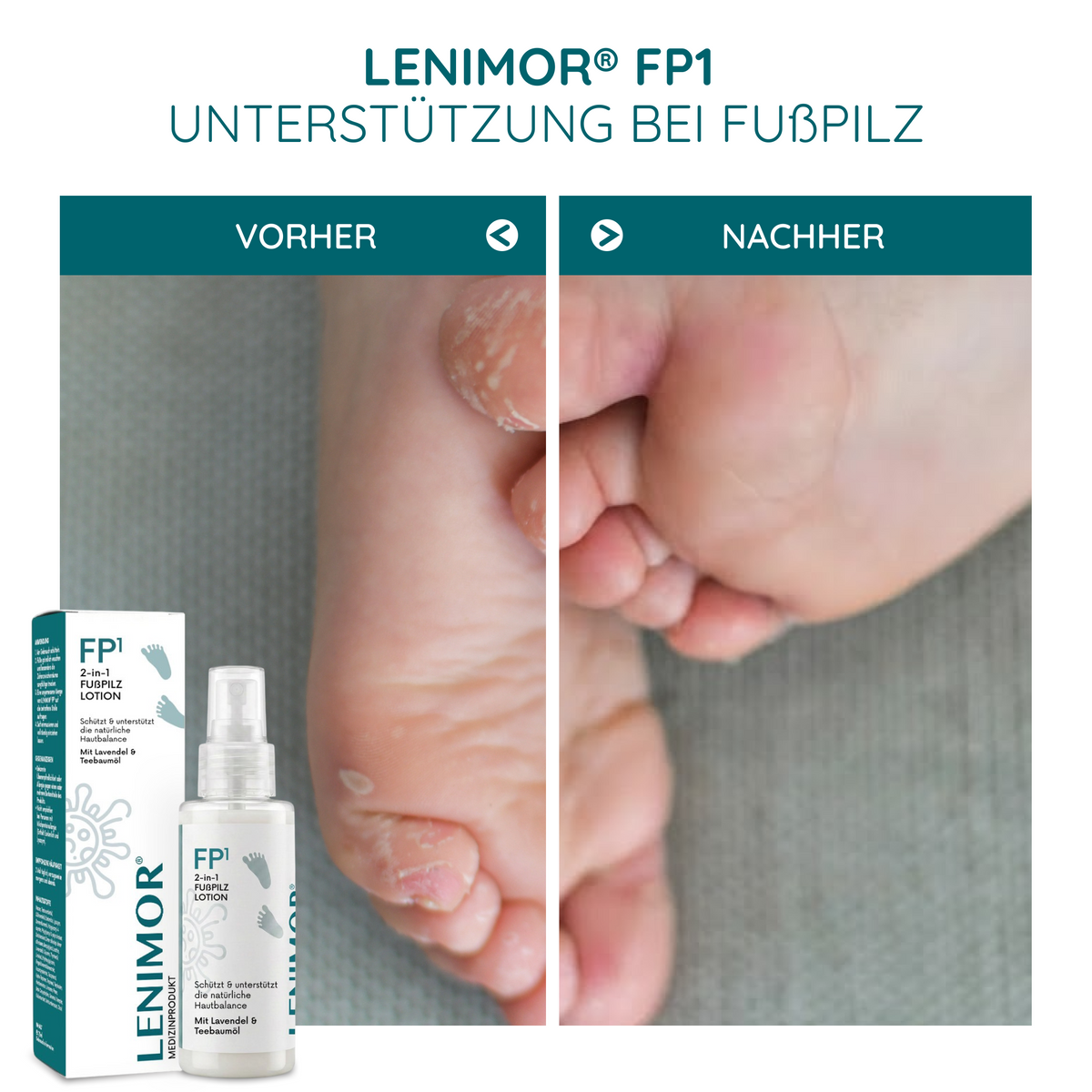 FUßPILZ Spray - Natürliche Formel mit Lavendel & Teebaumöl - 75ml